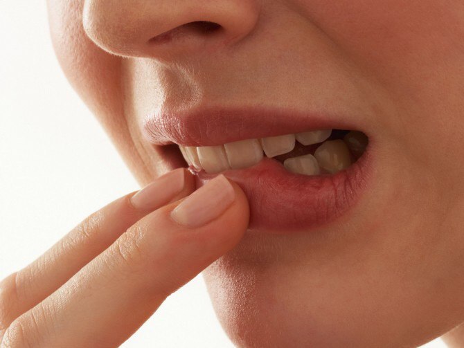 Перспективы лечения рака нижней губы