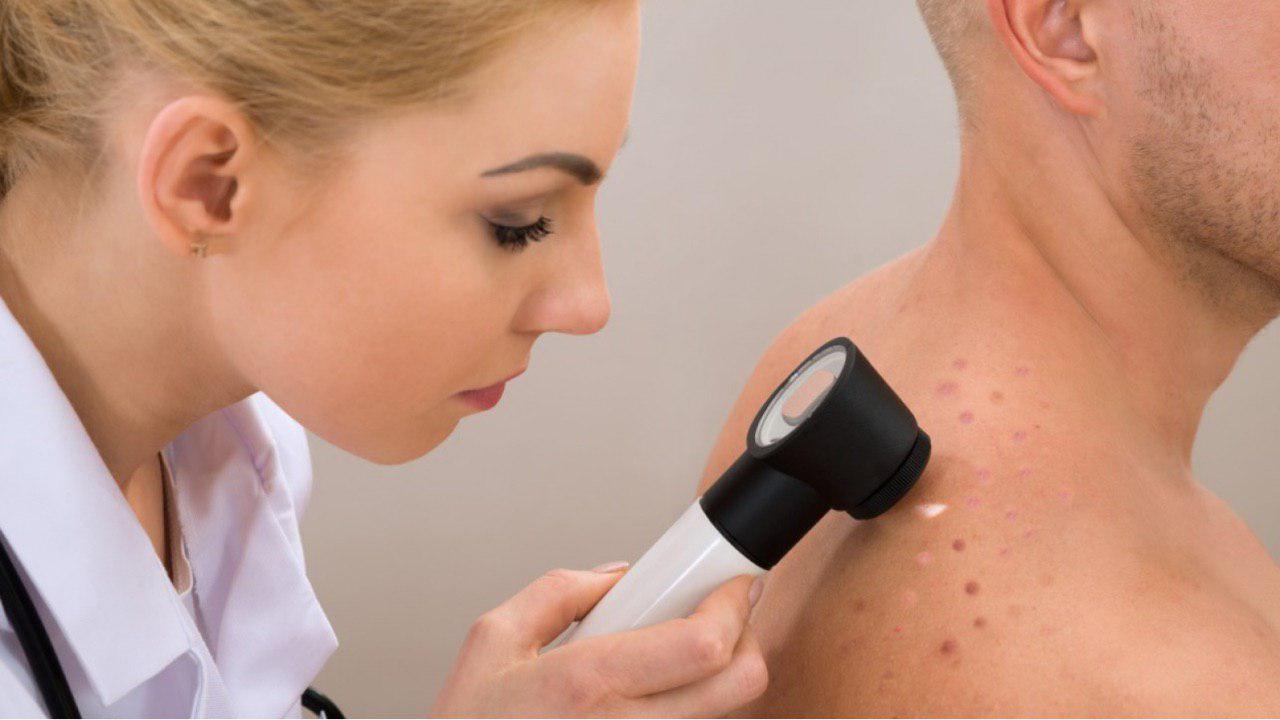 Мифы об онкологии: рак кожи