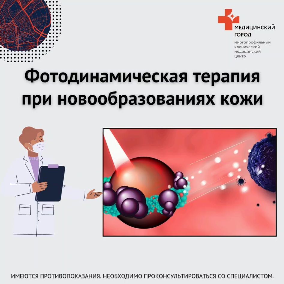ФОТОДИНАМИЧЕСКАЯ ТЕРАПИЯ ПРИ КОЖНЫХ НОВООБРАЗОВАНИЯХ