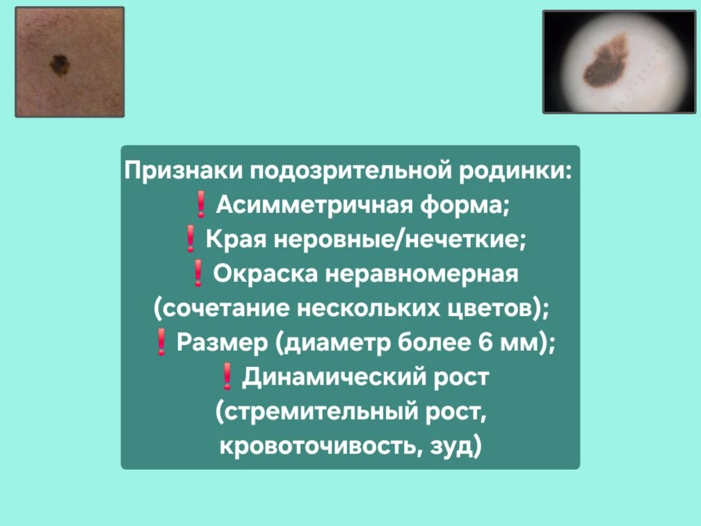 История одного диагноза: как внимательный осмотр спас жизнь пациенту Медицинского города