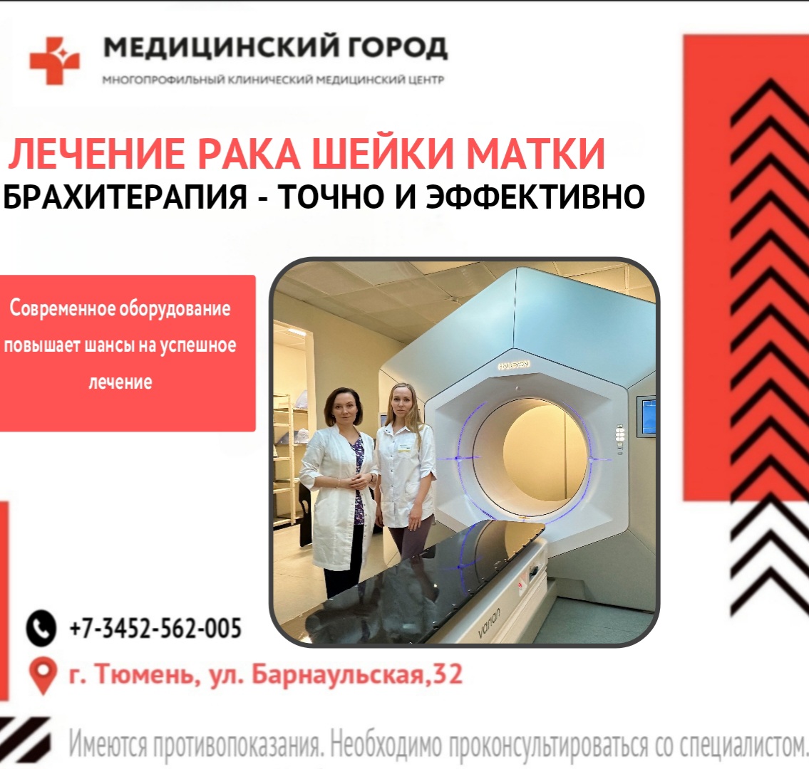 Лечение рака шейки матки: брахитерапия — точно и эффективно