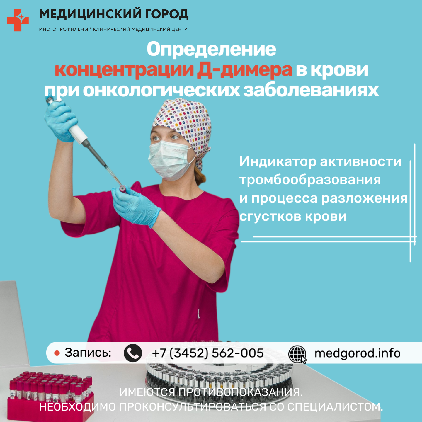 Определение концентрации Д-димера в крови при онкологических заболеваниях