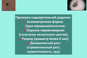 История одного диагноза: как внимательный осмотр спас жизнь пациенту Медицинского города